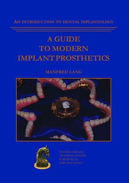 A guide to modern implant prosthetics: An introduction to dental implantology book
