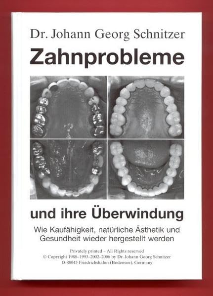 Zahnprobleme und ihre Überwindung: Wie Kaufähigkeit, natürliche Ästhetik und Gesundheit wieder hergestellt werden Medicine