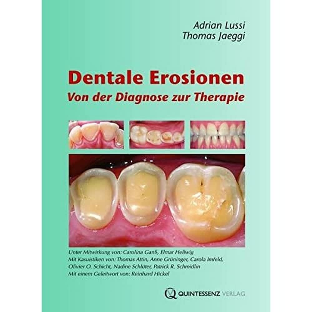 Dentale Erosionen: Von der Diagnose zur Therapie Medicine