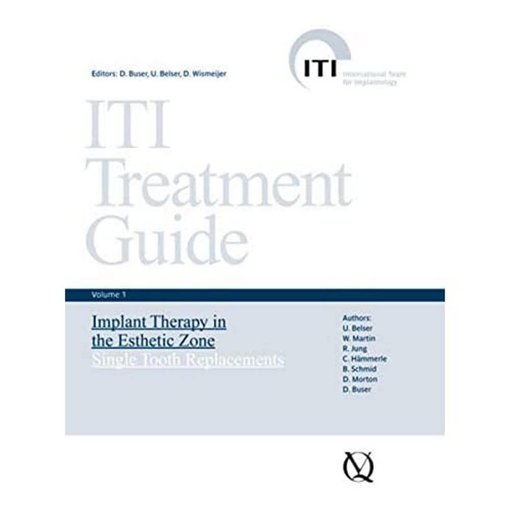 ITI Treatment Guide: Volume 1: Implant Therapy in the Esthetic Zone, Single-Tooth Replacements (ITI Treatment Guide Series (Engl.)) Medicine