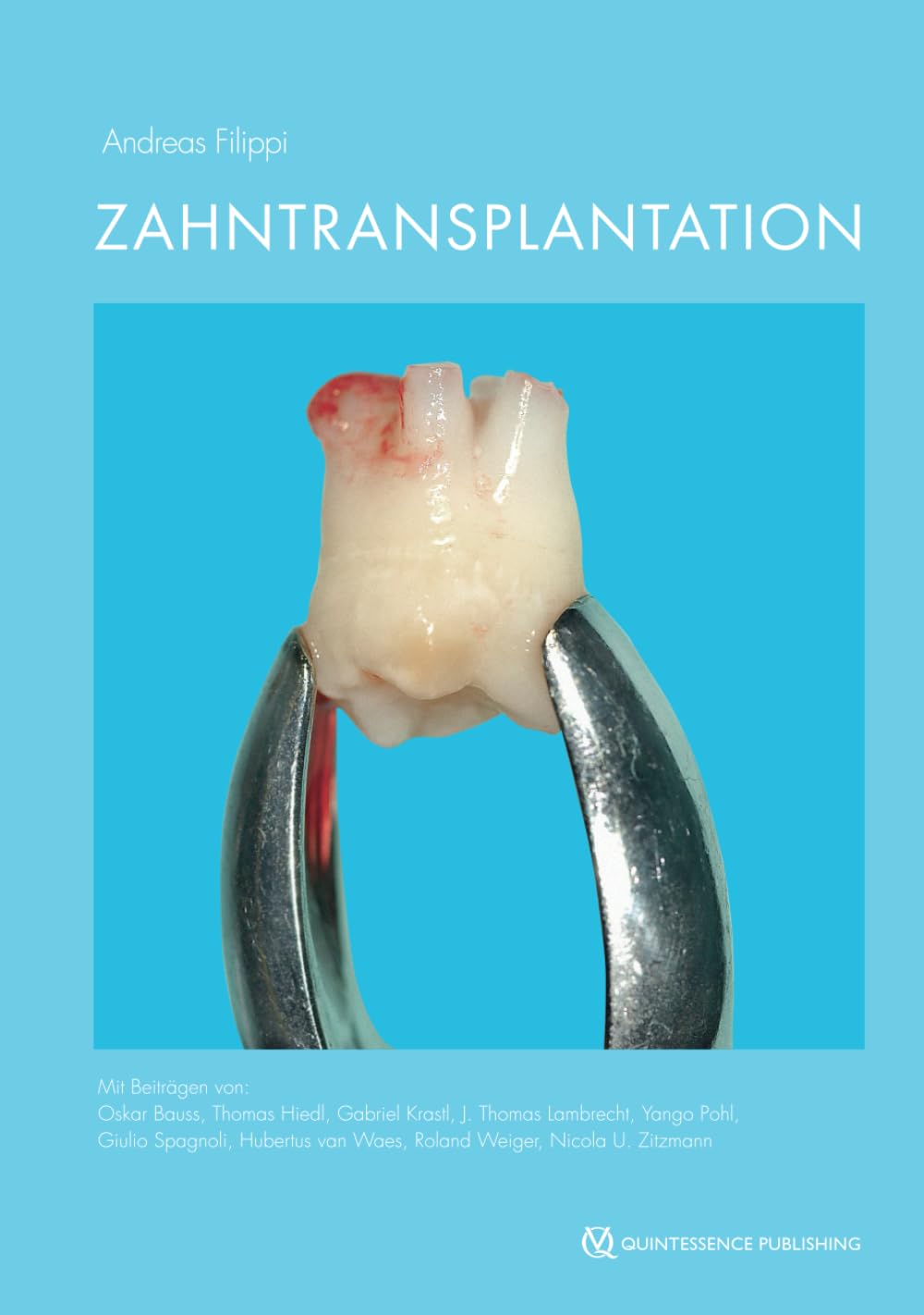 Zahntransplantation: Biologischer Zahnersatz für Kinder, Jugendliche und manche Erwachsene Medicine