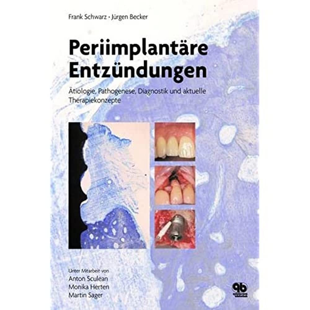 Periimplantäre Entzündungen: Ätiologie, Pathogenese, Diagnostik und aktuelle Therapiekonzepte book