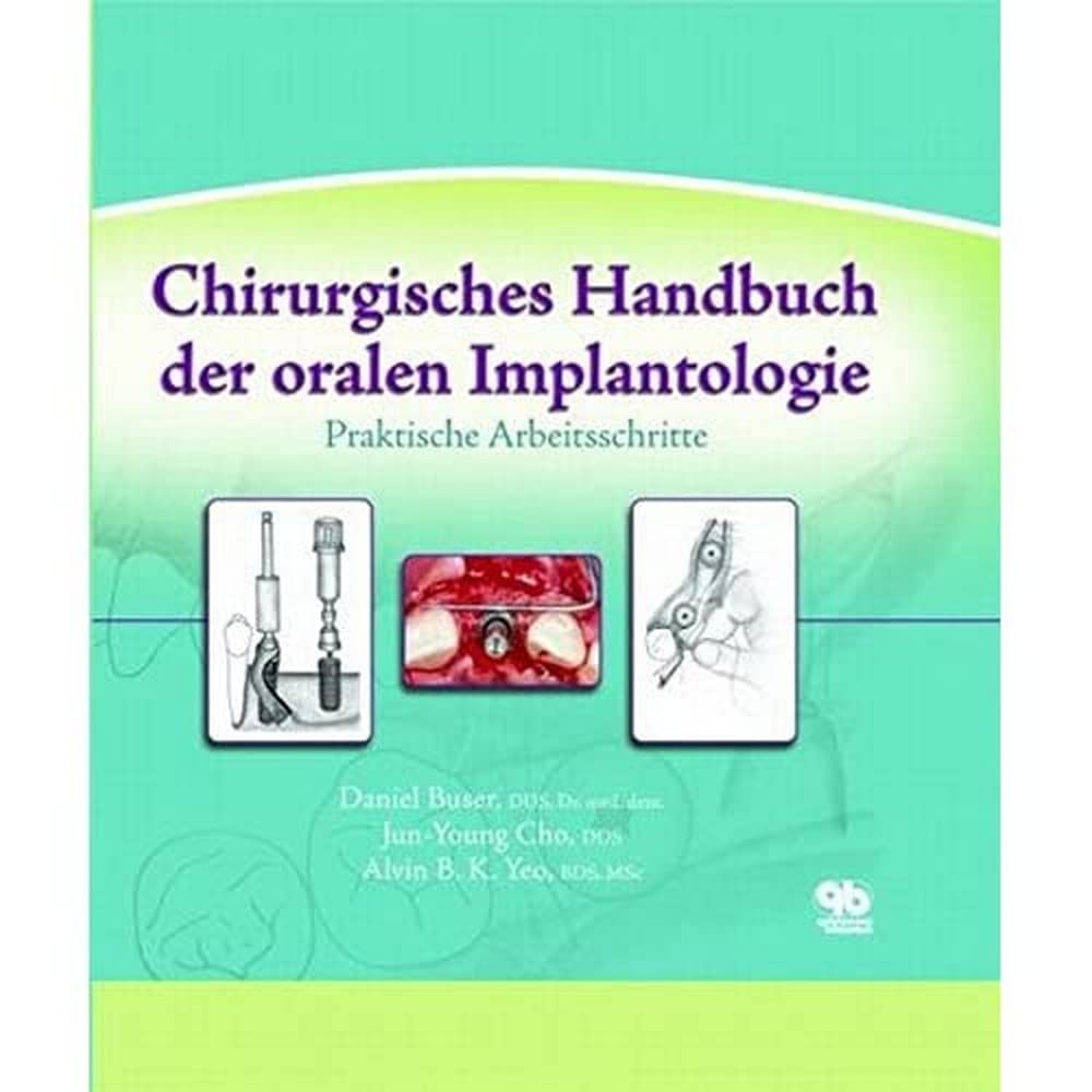 Chirurgisches Handbuch der oralen Implantologie: Praktische Arbeitsschritte book