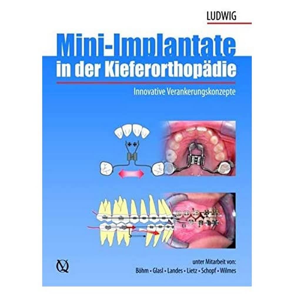 Mini-Implantate in der Kieferorthopädie Medicine