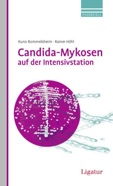 Candida-Mykosen auf der Intensivstation: Neue Therapieoptionen mit Anidulafungin Medicine