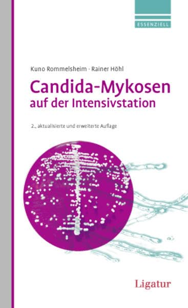 Candida-Mykosen auf der Intensivstation: Anidulafungin in der Primärtherapie Medicine