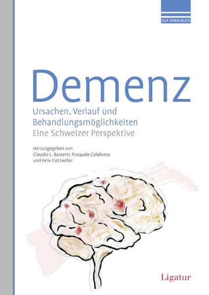 Demenz. Ursachen, Verlauf und Behandlungsmöglichkeiten.: Eine Schweizer Perspektive. Medicine
