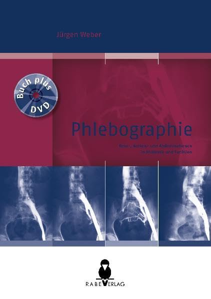 Phlebographie: Bein-, Becken- und Abdominalvenen in Anatomie und Funktion - Weber, Jürgen Medicine