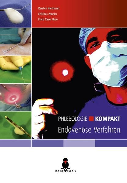 Phlebologie kompakt - Endovenöse Verfahren Medicine Books