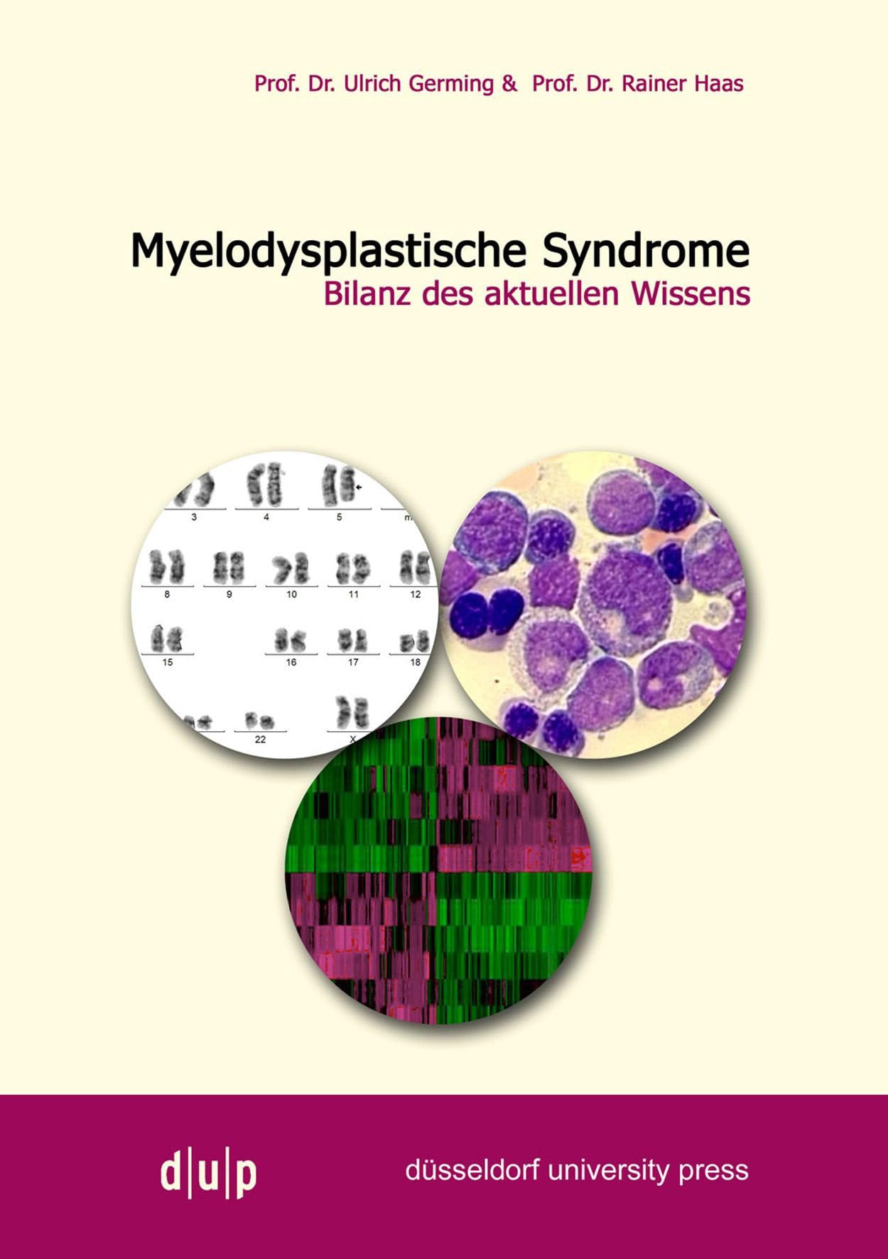 Myelodysplastiche Syndrome: Bilanz Des Aktuellen Wissens book