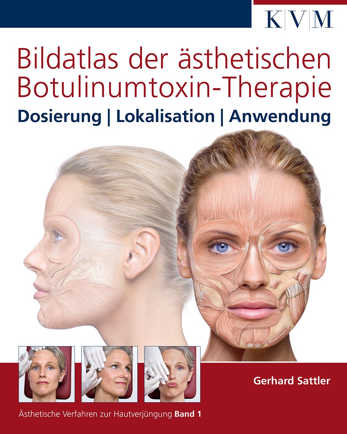 Hands-on 01. Bildatlas der ästhetischen Botulinumtoxin-Therapie Medicine
