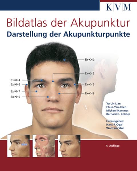Bildatlas der Akupunktur + CD-ROM, Set: Darstellung der Akupunkturpunkte Medicine