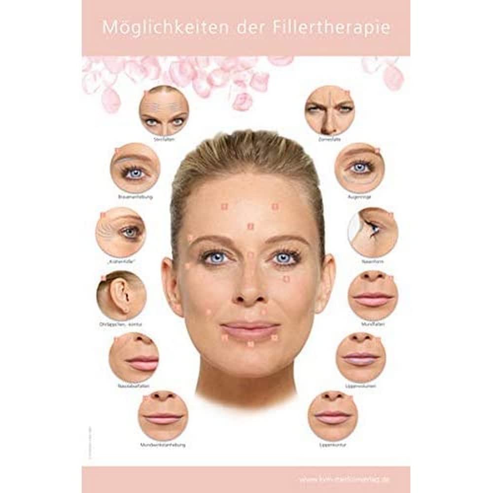 Poster Möglichkeiten der Fillertherapie book