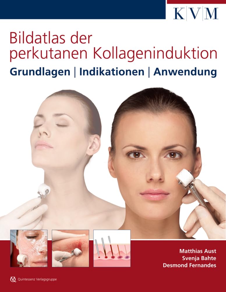 Bildatlas der perkutanen Kollageninduktion: Grundlagen | Indikationen | Anwendung Medicine
