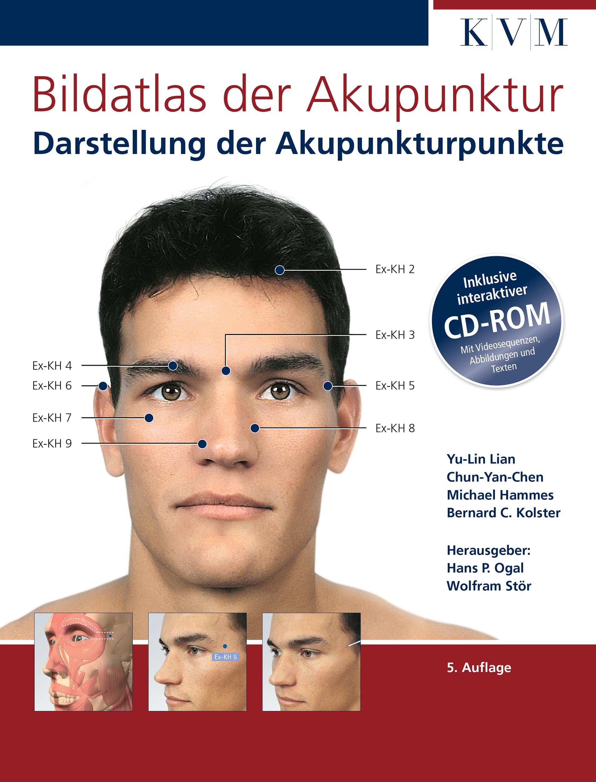 Bildatlas der Akupunktur Medicine