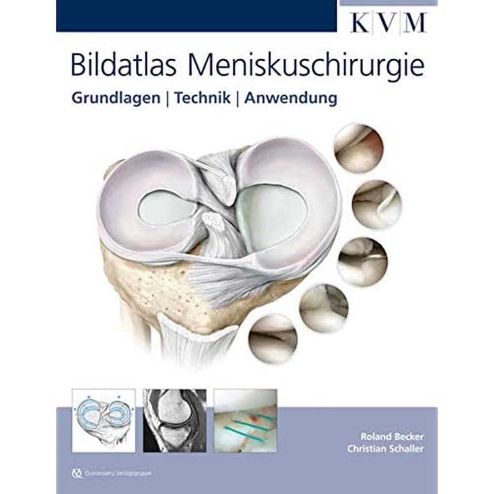 Bildatlas Meniskuschirurgie: Grundlagen | Technik | Anwendung Medicine