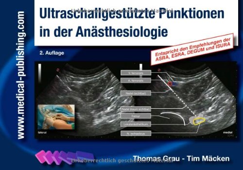 Ultraschallgestützte Punktionen in der Anästhesiologie book