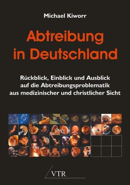 Abtreibung in Deutschland: Rückblick, Einblick und Ausblick auf die Abtreibungsproblematik aus medizinischer und christlicher Sicht - Kiworr, Michael book