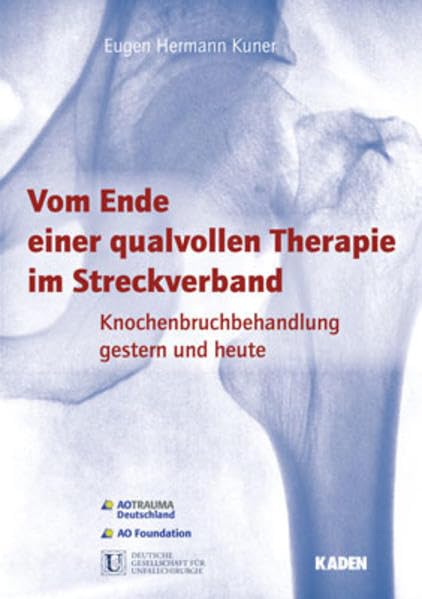 Vom Ende einer qualvollen Therapie im Streckverband: Knochenbruchbehandlung gestern und heute Medicine