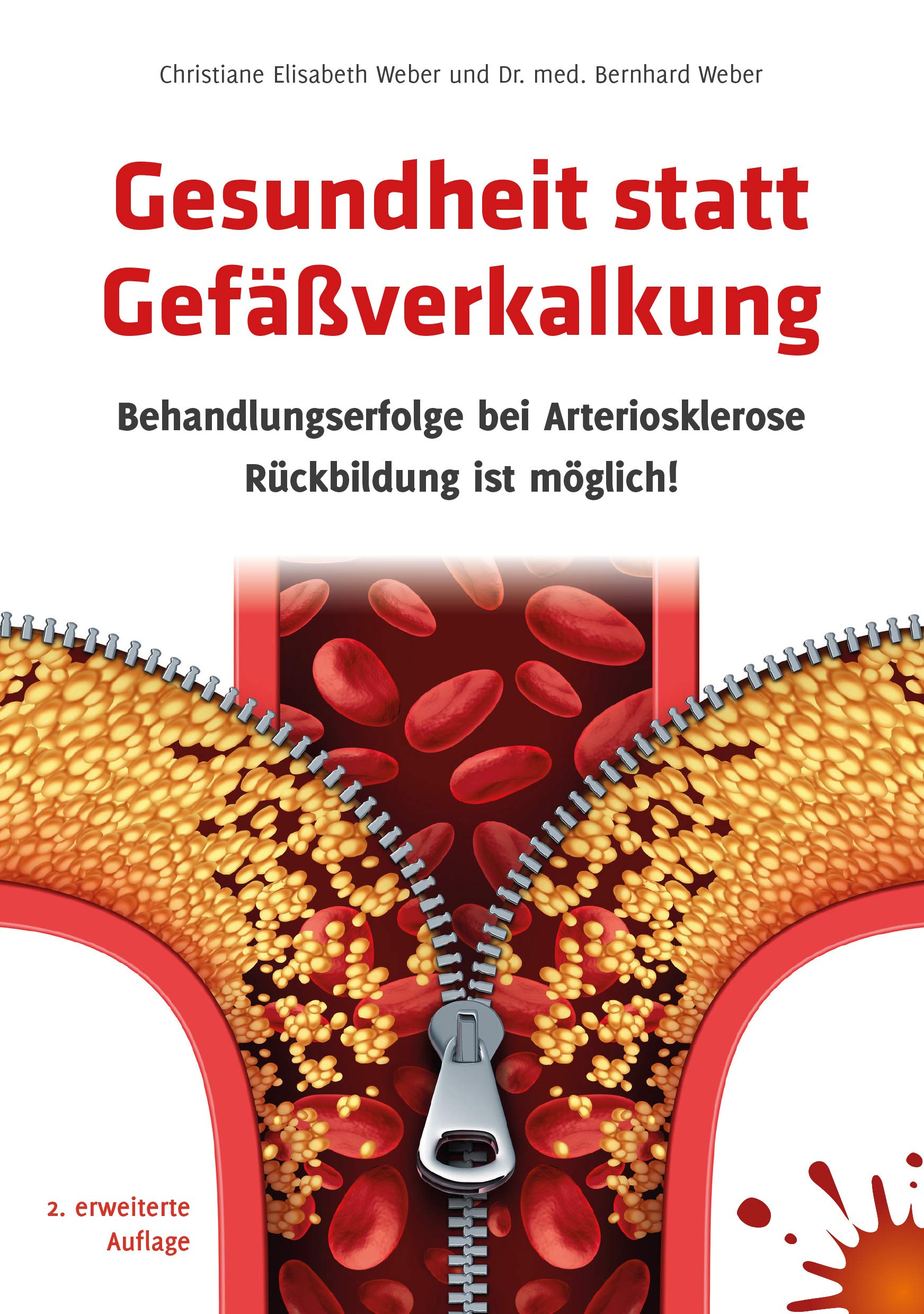 Gesundheit statt Gefäßverkalkung: Behandlungserfolge bei Arteriosklerose - Rückbildung ist möglich!: Behandlungserfolge bei Arteriosklerose – Rückbildung ist möglich 2. erweiterte Auflage! Medicine