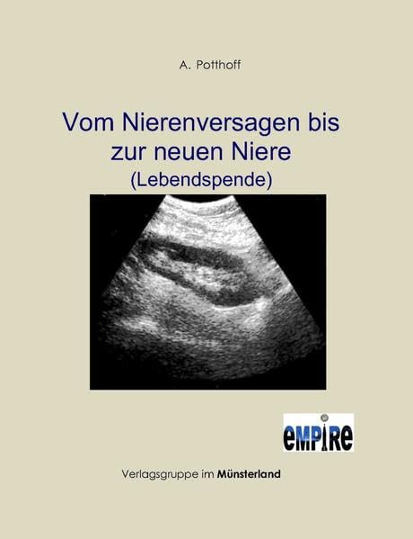 Vom Nierenversagen bis zur neuen Niere (Lebendspende): Versuch eines Sachberichtes Medicine