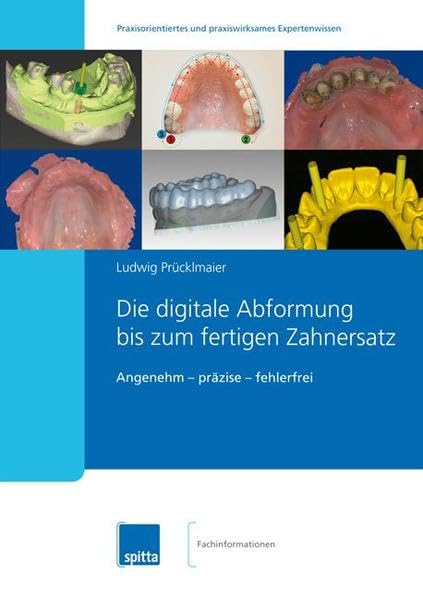 Die digitale Abformung bis zum fertigen Zahnersatz: Angenehm – präzise – fehlerfrei Medicine