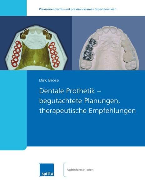 Dentale Prothetik - begutachtete Planungen, therapeutische Empfehlungen Medicine