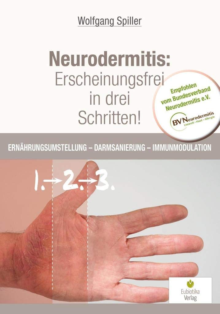 Neurodermitis: Erscheinungsfrei in drei Schritten!: Ernährungsumstellung - Darmsanierung - Immunmodulation Medicine