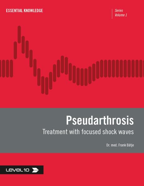 Pseudarthrosis: Treatment with focused shock waves (Schriftenreihe Kompaktwissen) Medicine