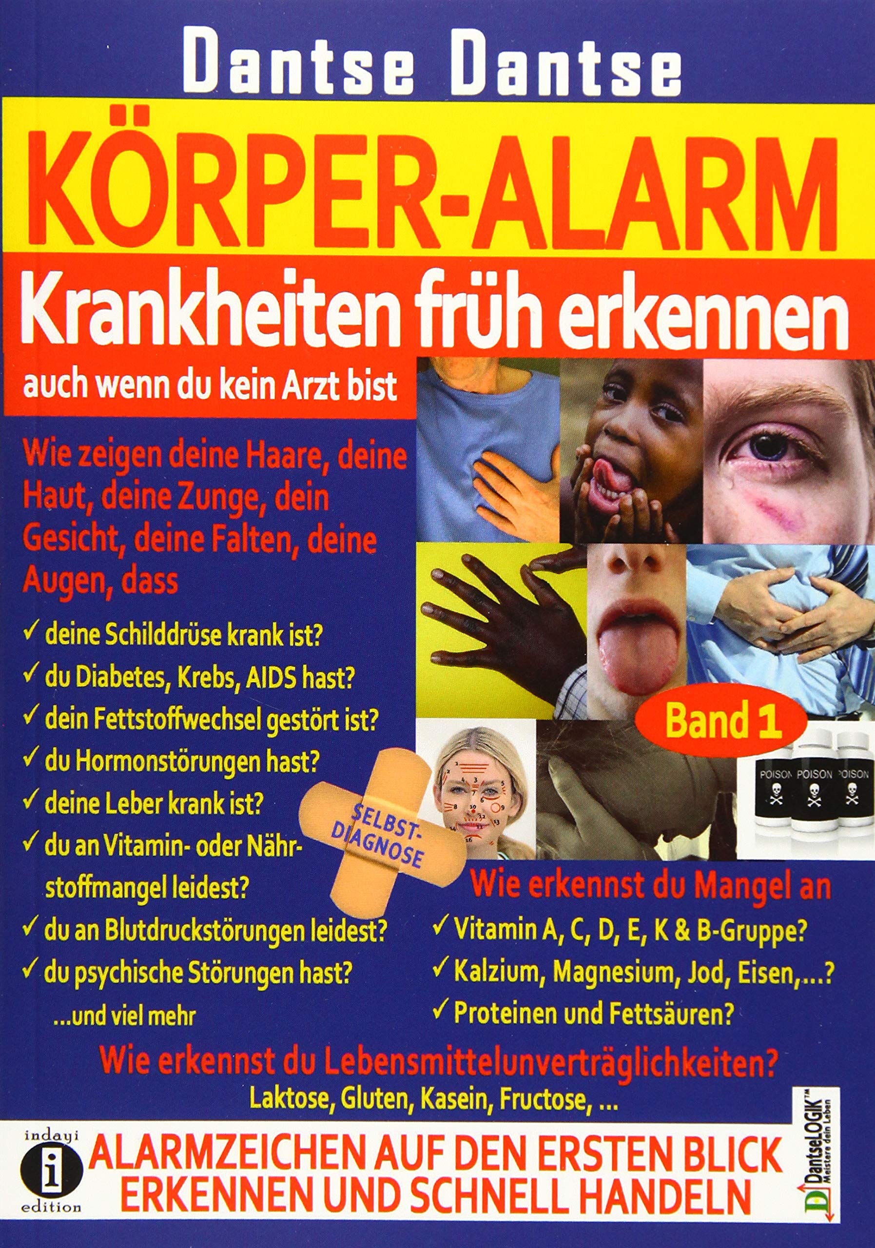 KÖRPER-ALARM - Krankheiten früh erkennen, auch wenn du kein Arzt bist! Band 1: Reference Books