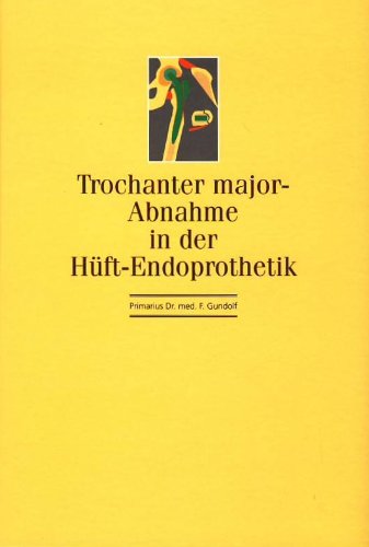 Trochanter major - Abnahme in der Hüft-Endoprothetik. Books