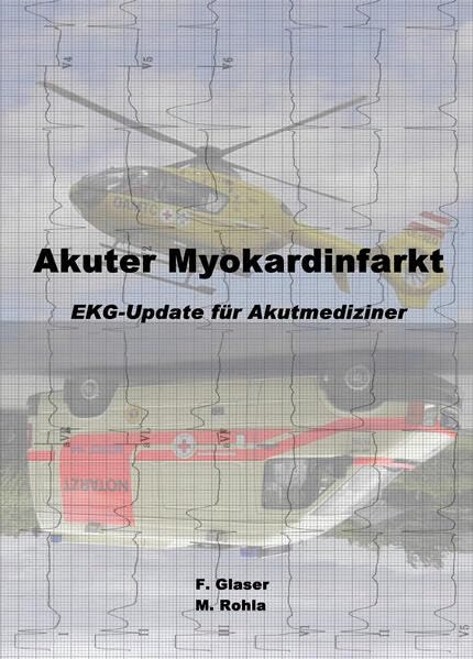 Akuter Myokardinfarkt book