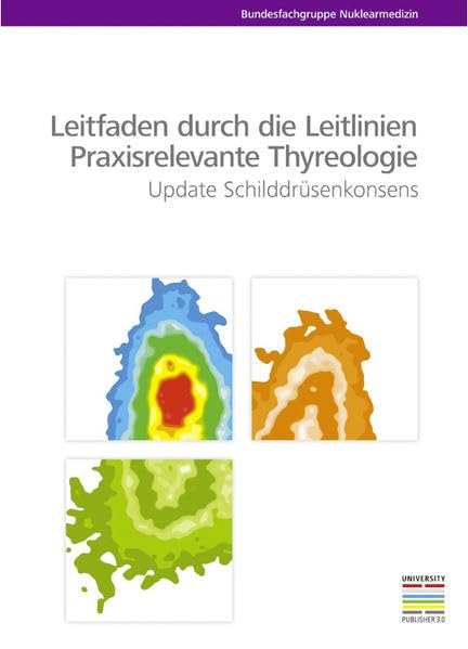Leitfaden durch die Leitlinien – Praxisrelevante Thyreologie: Update Schilddrüsenkonsens Medicine