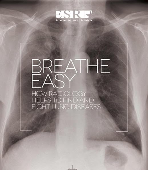 Breathe Easy: How radiology helps to find and fight lung diseases Medicine