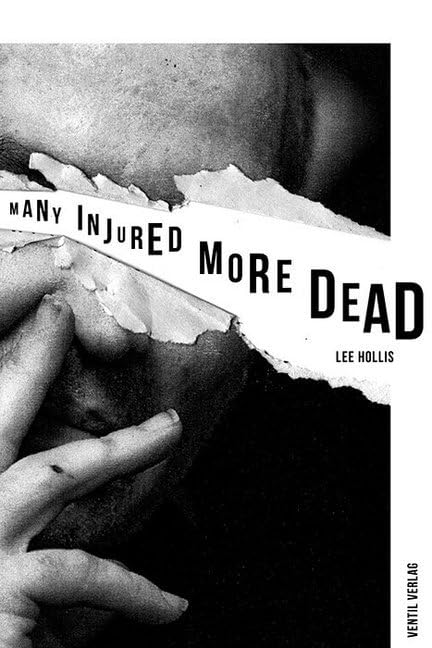 Product Image: Many Injured, More Dead