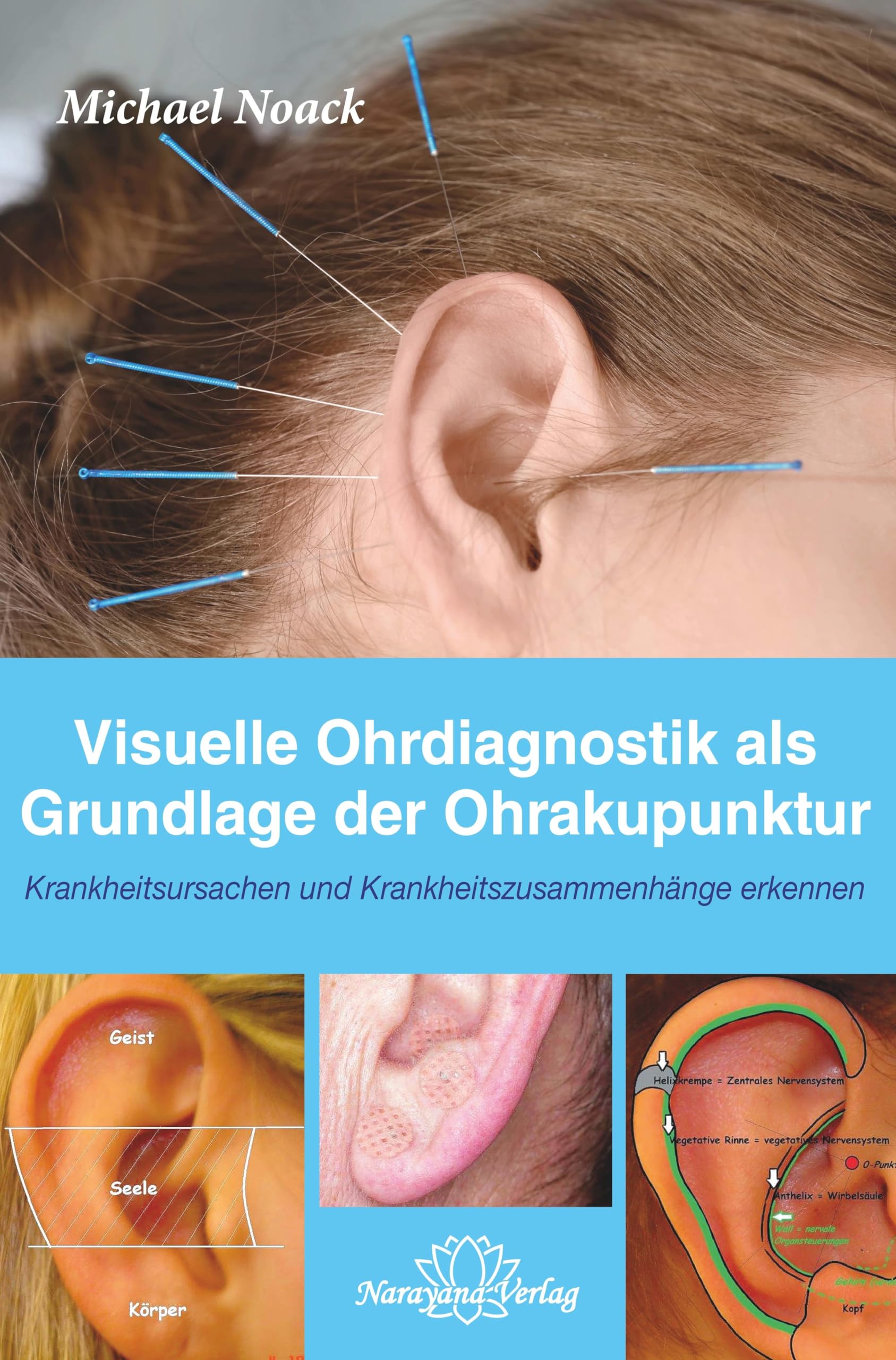 Visuelle Ohrdiagnostik als Grundlage der Ohrakupunktur - Krankheitsursachen und Krankheitszusammenhänge erkennen Health, Nutrition & Fitness