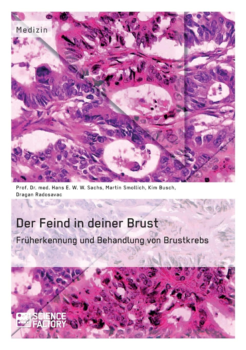 Der Feind in deiner Brust. Früherkennung und Behandlung von Brustkrebs Medicine