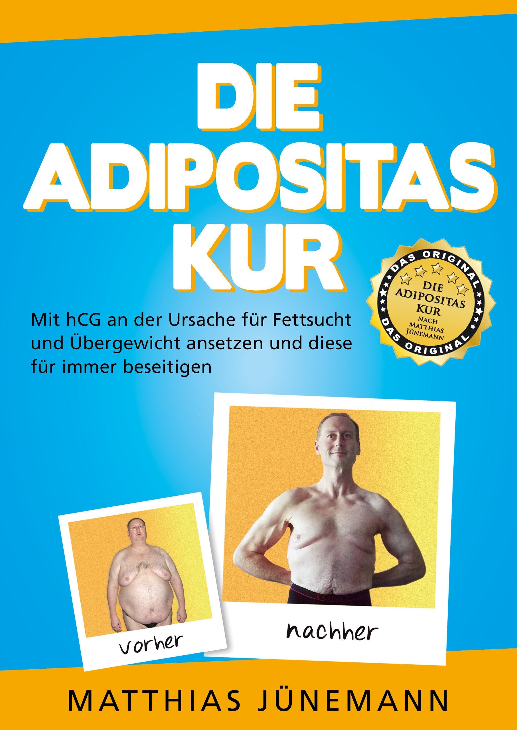 Die Adipositas-Kur: Mit hCG an der Ursache für Fettsucht und Übergewicht ansetzen und diese für immer beseitigen Health, Nutrition & Fitness