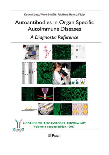 Product Image: Autoantibodies in Organ Specific Autoimmune Diseases – A Diagnostic Reference
