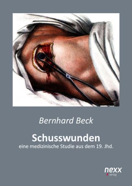 Schusswunden: eine medizinische Studie aus dem 19. Jhd. Medicine