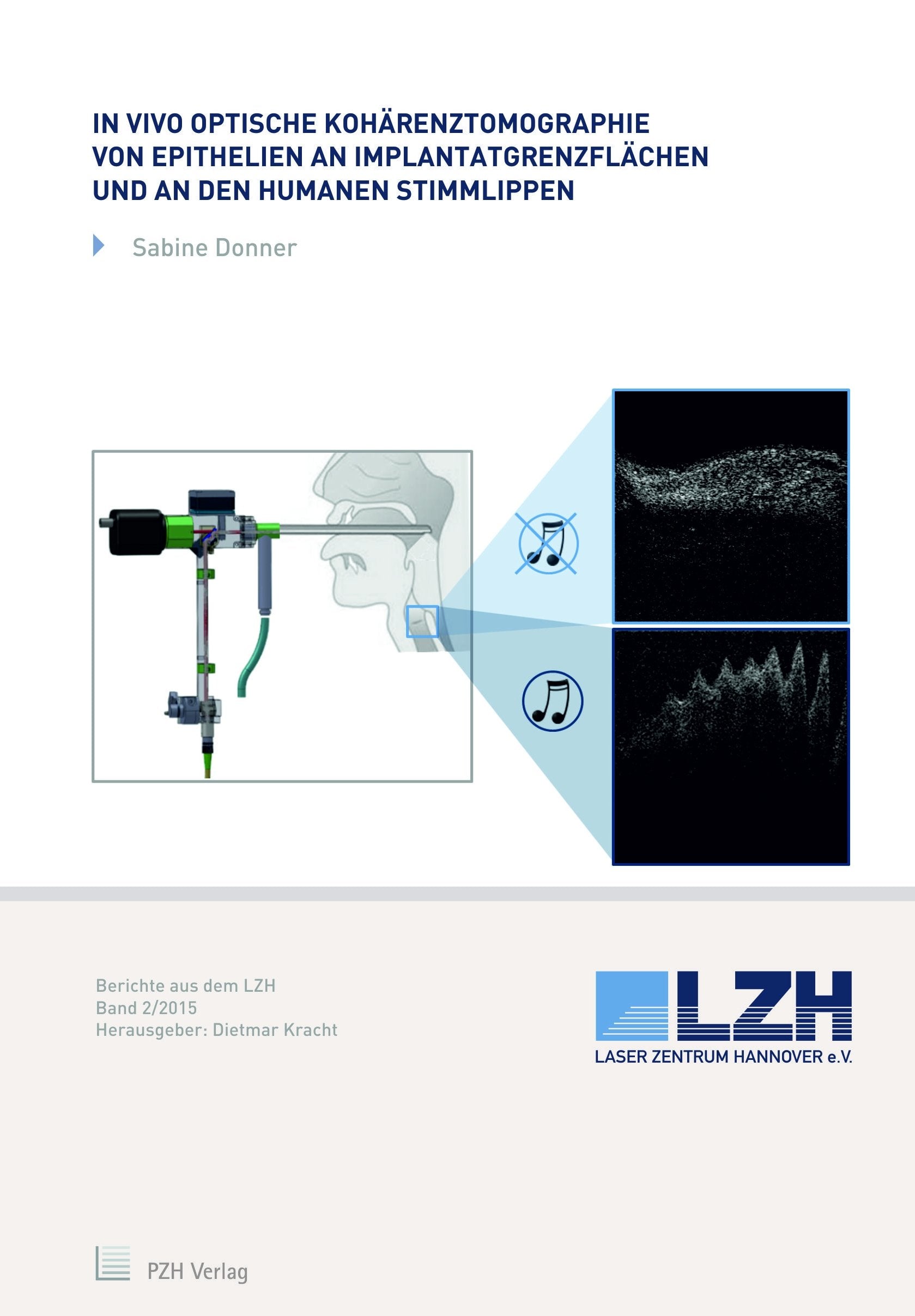 In vivo optische Kohärenztomographie von Epithelien an Implantatgrenzflächen und an den humanen Stimmlippen (Berichte aus dem LZH) Business & Technology