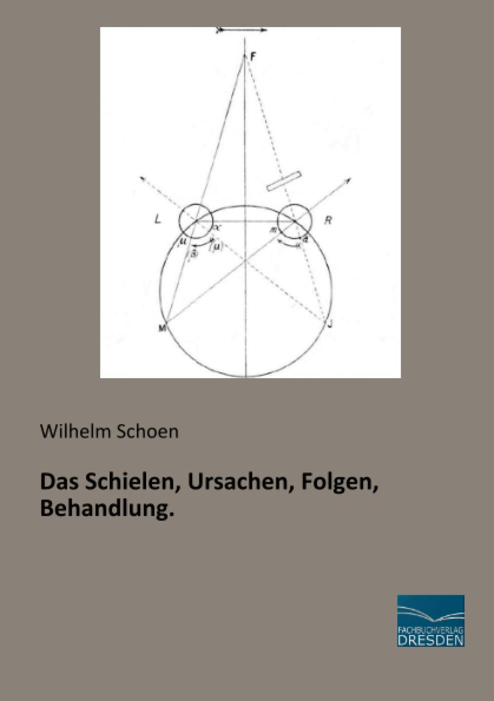 Das Schielen, Ursachen, Folgen, Behandlung. Medicine