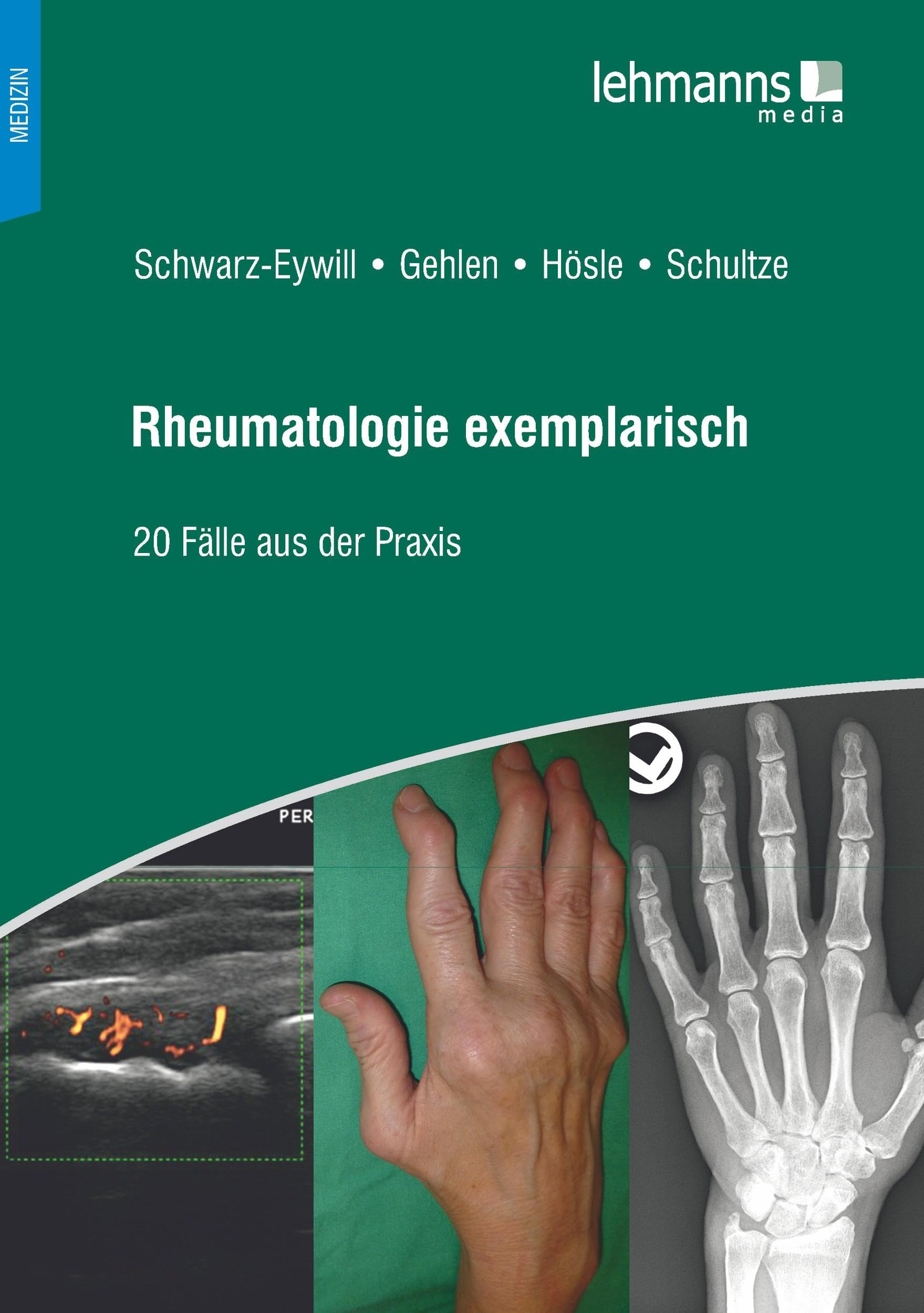 Rheumatologie exemplarisch: 20 Fälle aus der Praxis Medicine