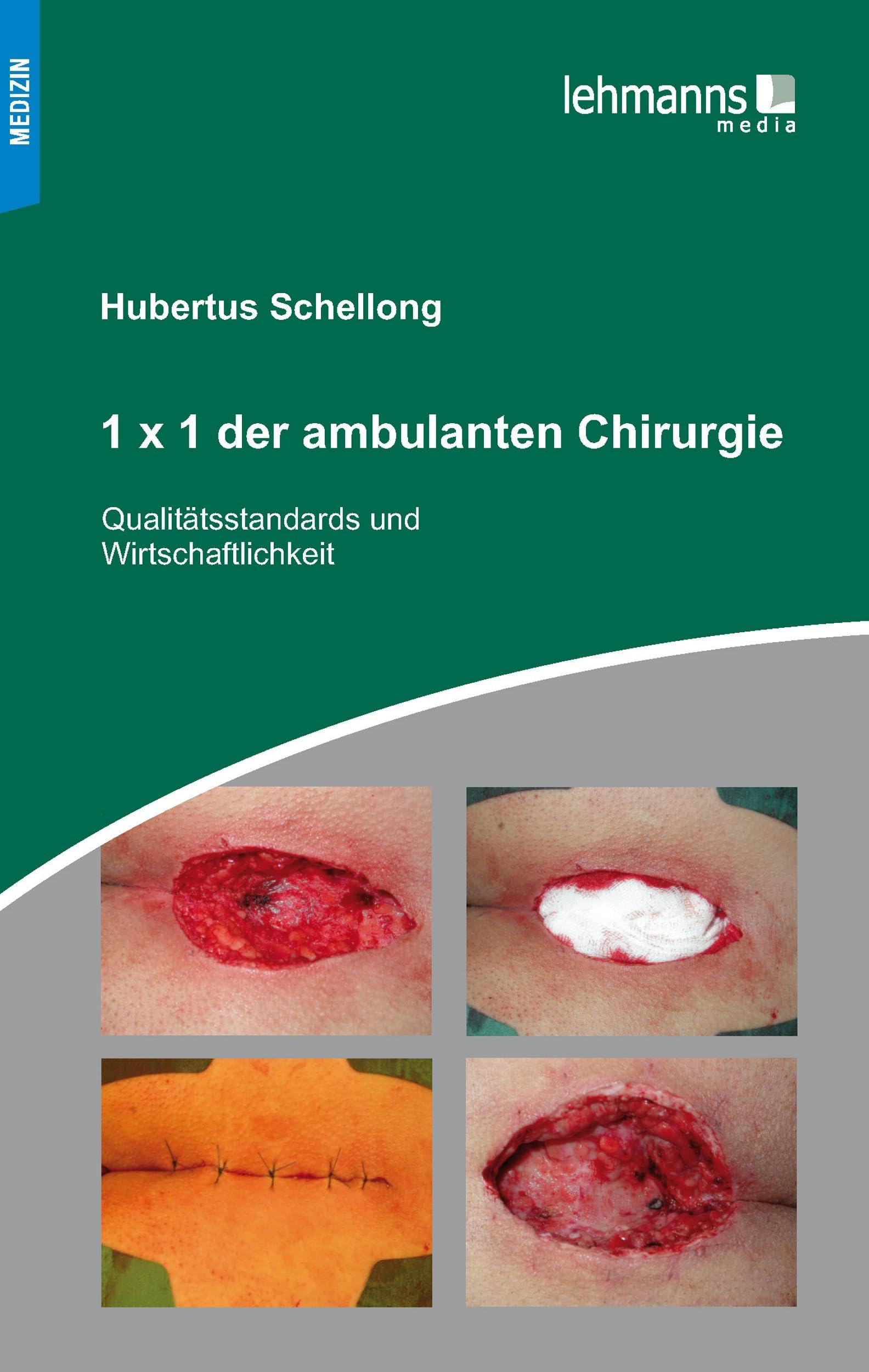 1x1 der ambulanten Chirurgie: Qualitätsstandards und Wirtschaftlichkeit Medicine