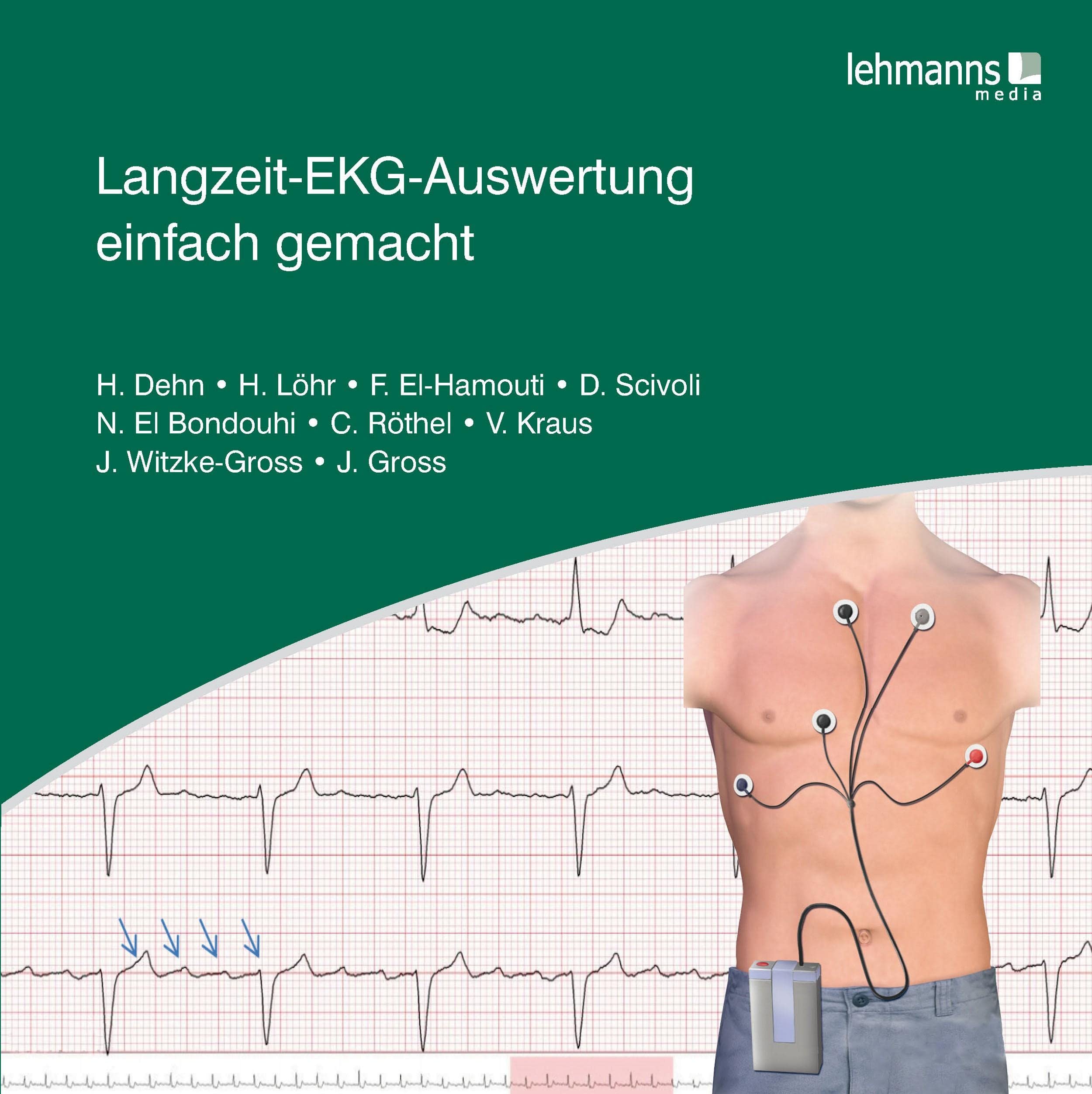 Langzeit-EKG-Auswertung einfach gemacht Medicine