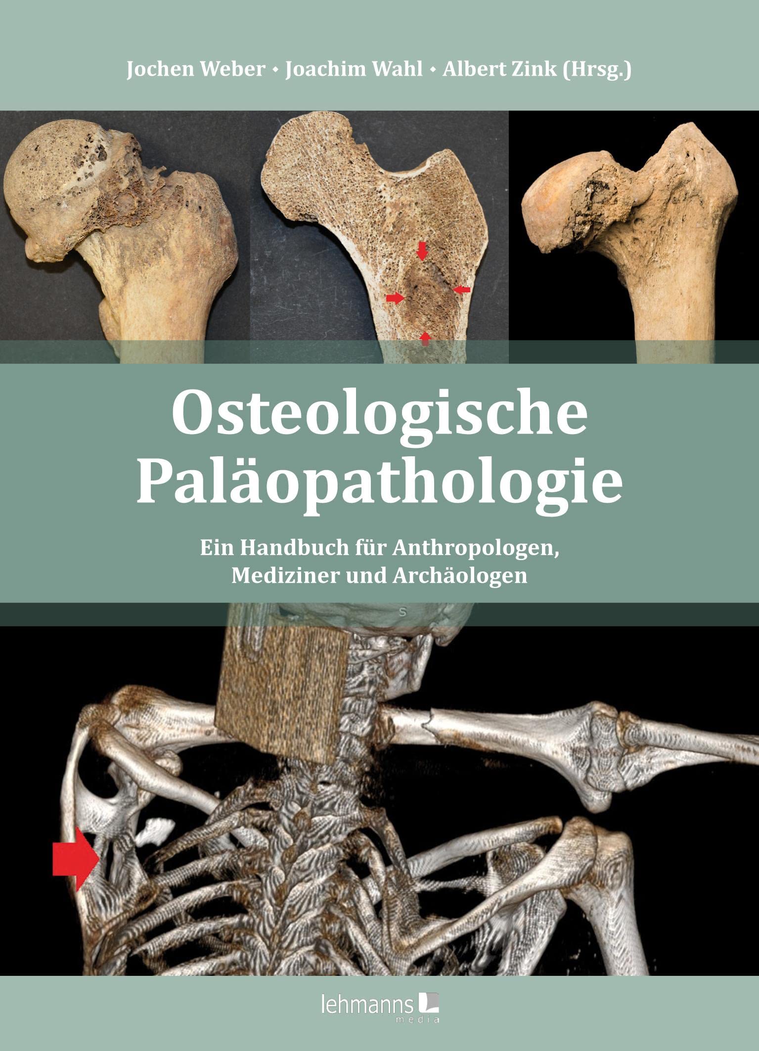 Osteologische Paläopathologie: Ein Handbuch für Anthropologen, Mediziner und Archäologen Medicine