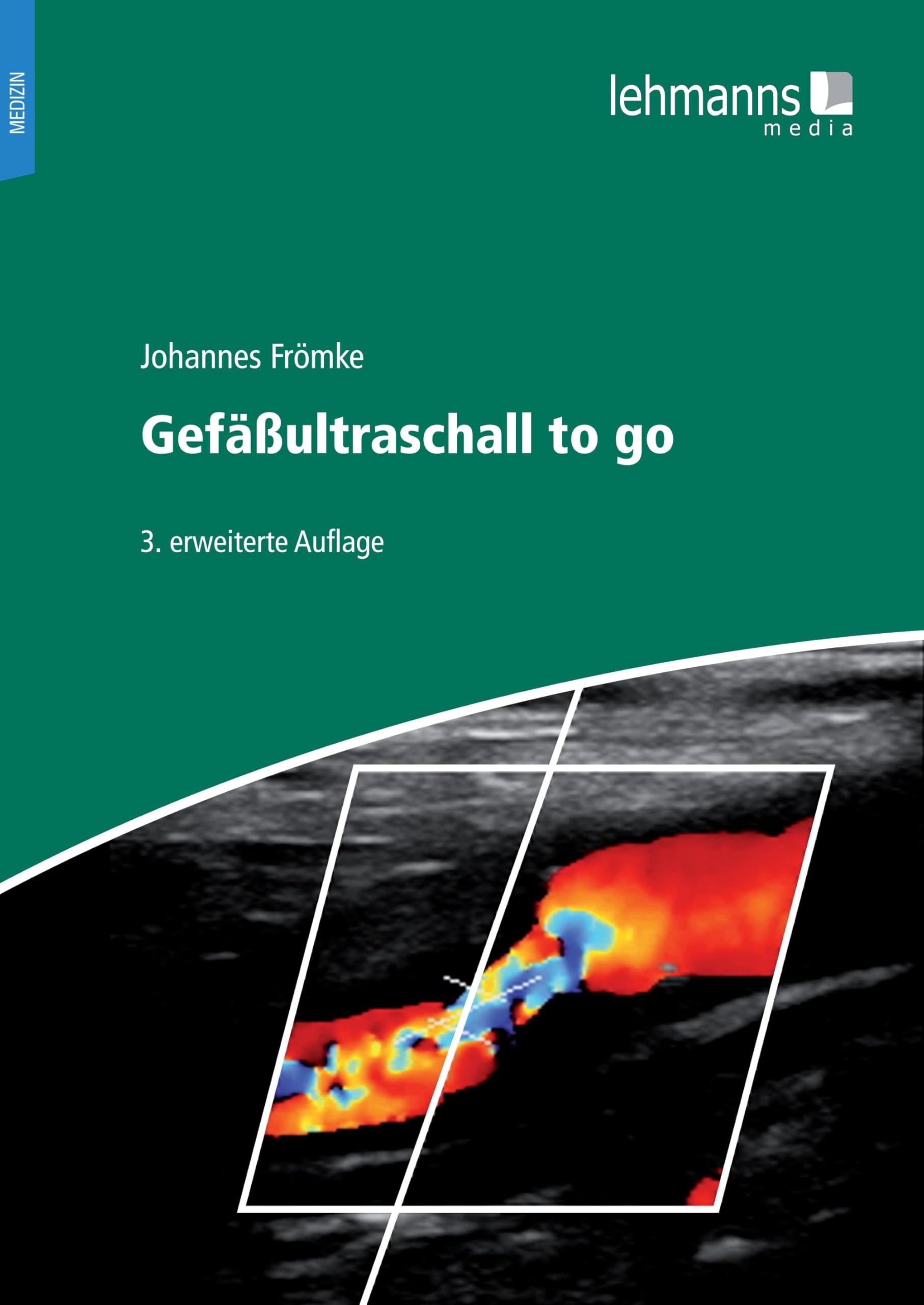 Gefäßultraschall to go Medicine
