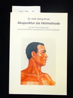 Akupunktur als Heilmethode. aus der Praxis dargestellt anhand zahlreicher Illustr. und Krankheitsbilder. o.A. Health, Nutrition & Fitness