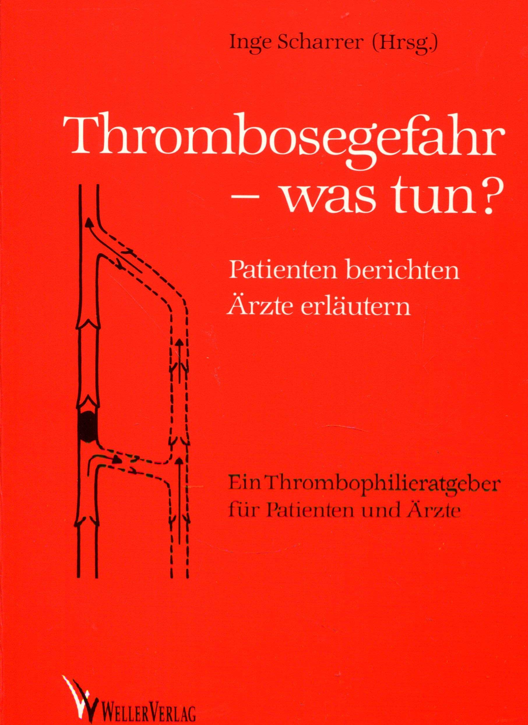 Thrombosegefahr- was tunß? Scharrer book