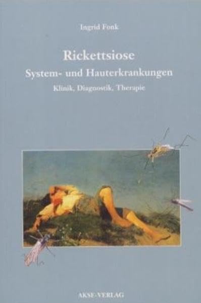 Rickettsiose – System- und Hauterkrankungen. Klinik, Diagnostik, Therapie Medicine